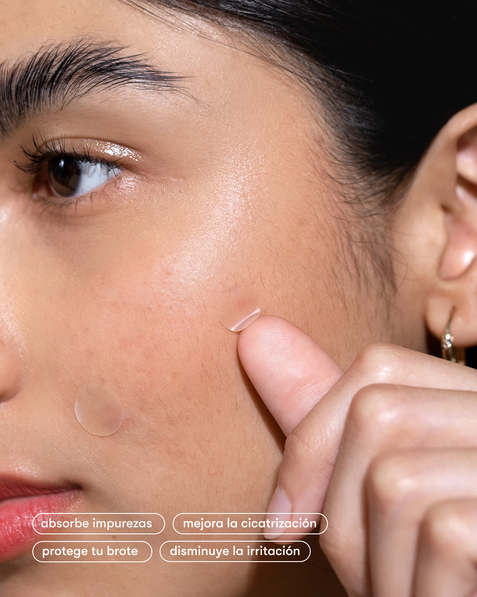Pimple Hugger Bundles (Packs de parches para brotes)